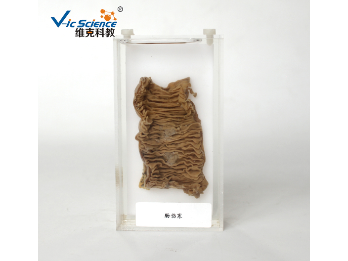 周口肝硬化大体标本价格,大体标本
